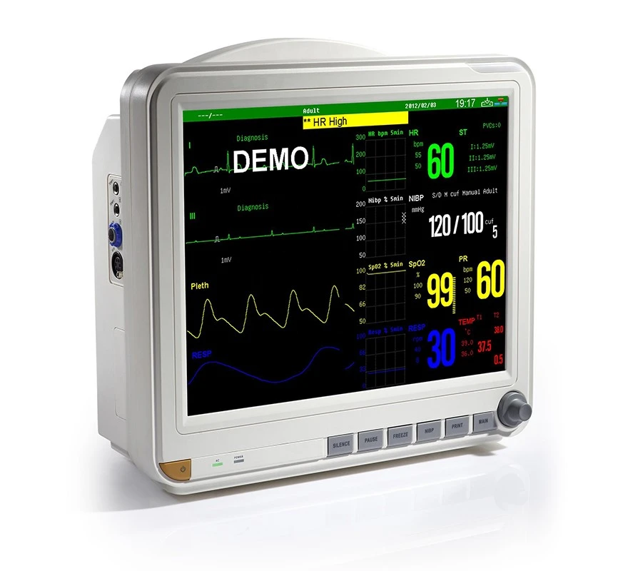 Veterinary Multi-Parameter Monitor Price Veterinary Multi-Parameter Monitor Price