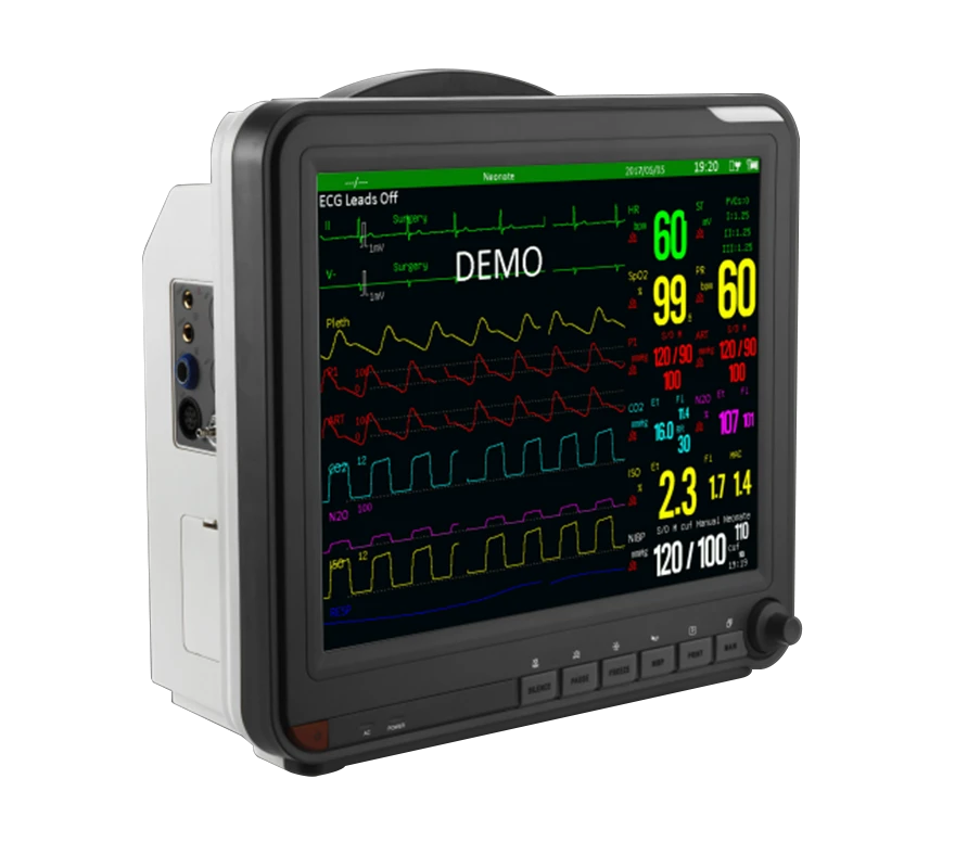 Veterinary Multi-Parameter Monitor Pricelist Veterinary Multi-Parameter Monitor Pricelist