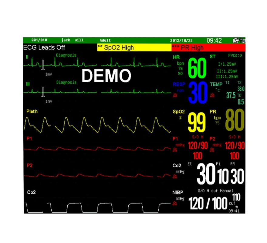 Veterinary Multi-Parameter Monitor Quotation Veterinary Multi-Parameter Monitor Quotation