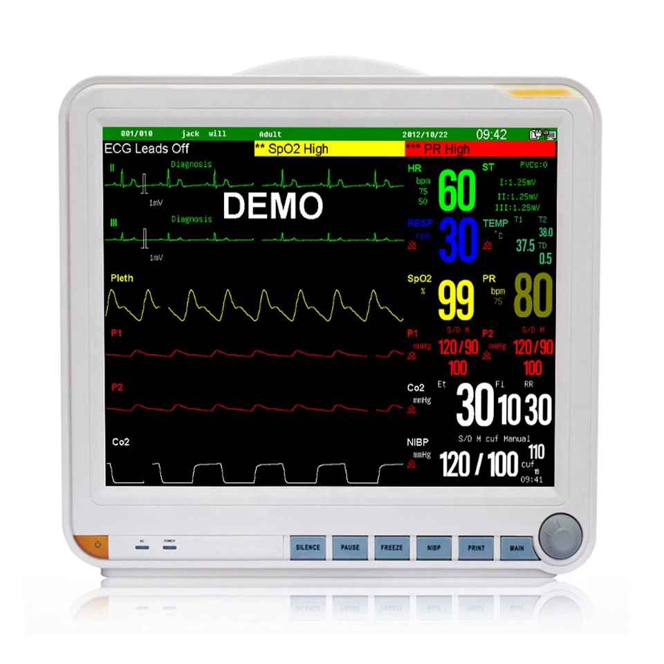 Veterinary Multi-Parmeter Monitor